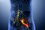 Sciatica nerve disorder, Sciatica, help yourself on sciatica, Sciatica nerve Sciatica nerve disorder, Sciatica, help yourself on sciatica, Sciatica nerve