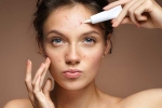 face problems, what your face says about your health, what your face is telling you about your health, Pimples face problems, what your face says about your health, what your face is telling you about your health, Pimples